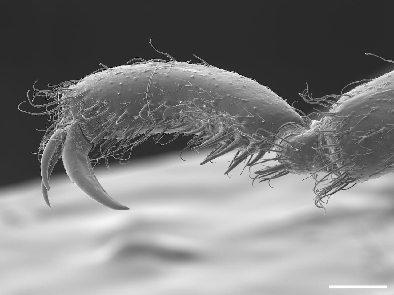 A microscopic image showing a sea spider leg.